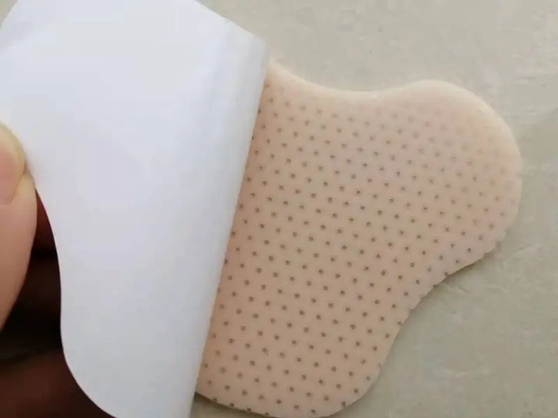 nasal splint thermoplastic.jpg