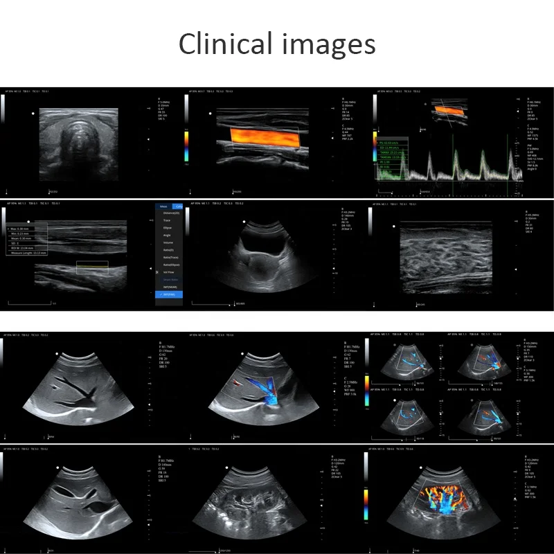 Китай портативный ультразвуковой аппарат цена Equipos De Ultrasonido Medico 4D для медицинских