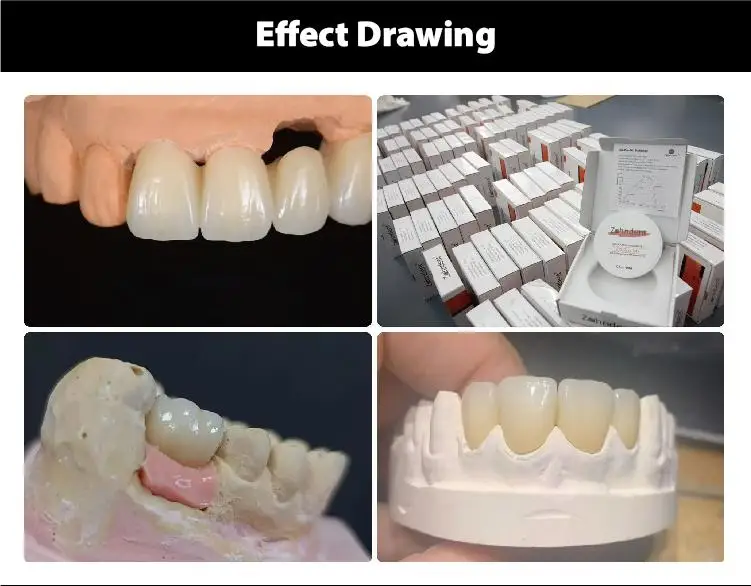 Zahndent customizable dental open cad cam system milling machine zirconia block for other dental equipments