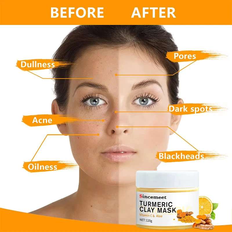 OEM Wholesale Private Label Organic Brighten Black Head Removal Anti Aging Anti Acne Vitamin C Turmeric Clay Mask