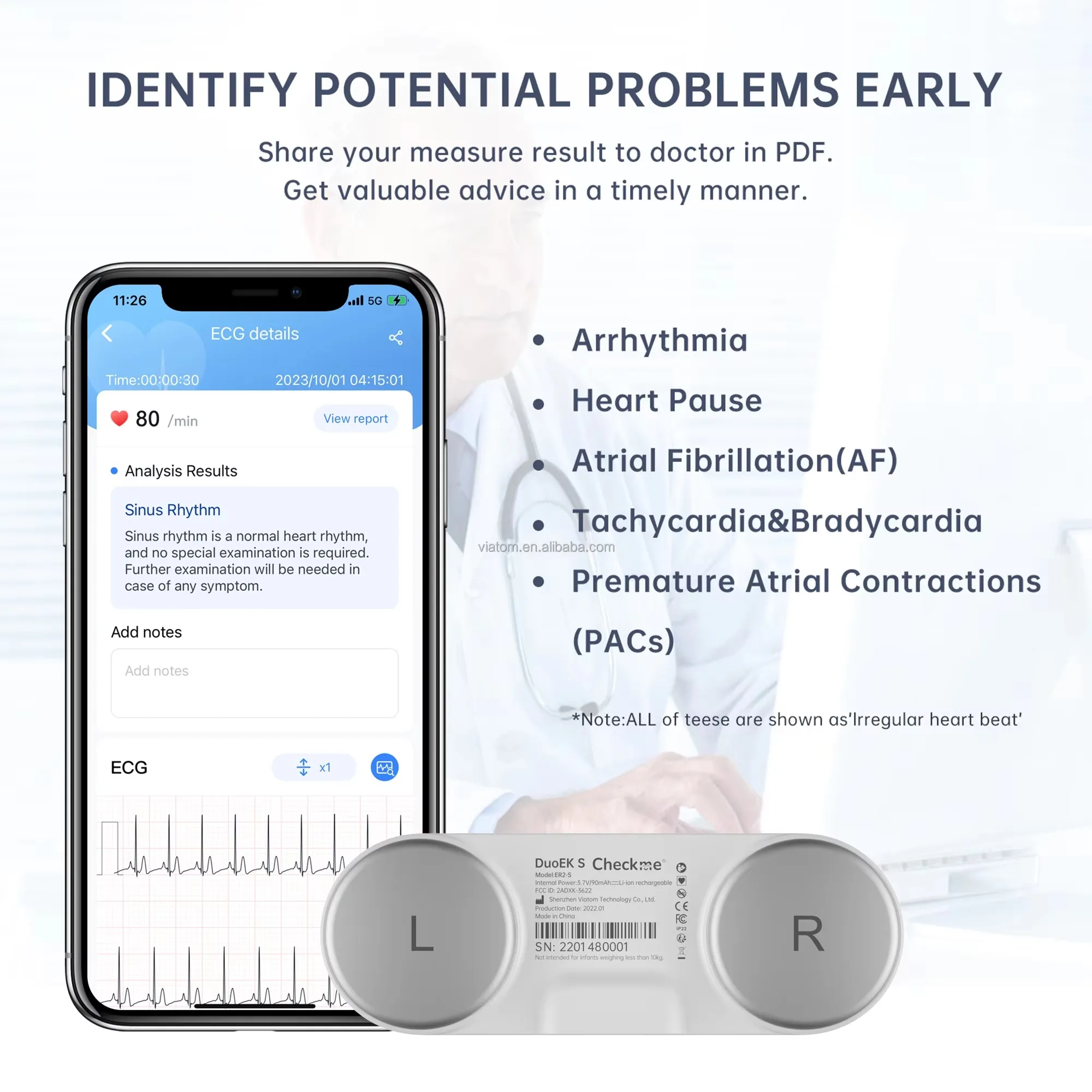 Персональный портативный смарт-Bluetooth водонепроницаемый пластиковый датчик отпечатков пальцев оборудование для отслеживания состояния пульсометр