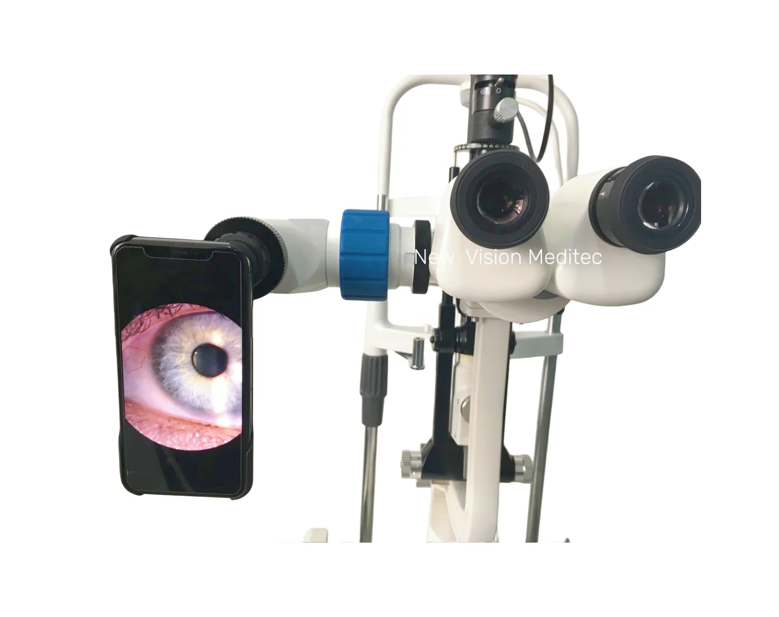 8K Smartphone Video Adapter for Surgical Microscopes and Slit Lamps