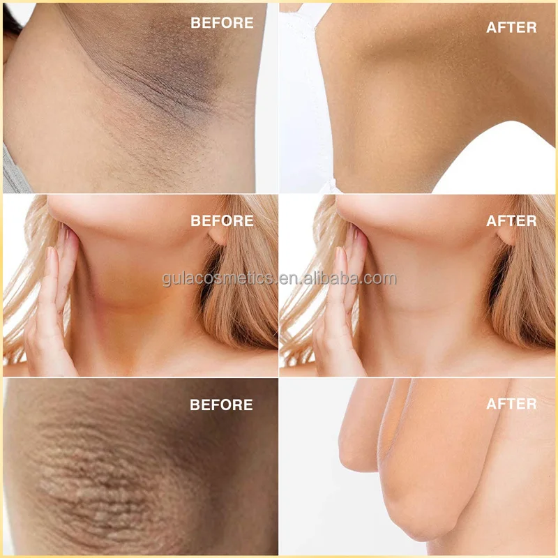 2024 Wholesale in stock 60g*2 bar Kojic Lightening Acne Treatment Soap skin brightening body and face Soap