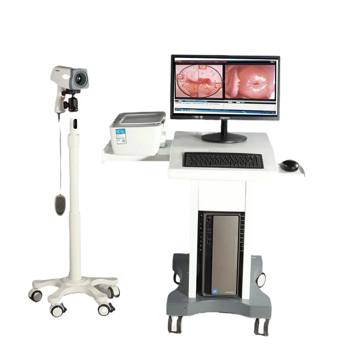Colposcope Video KN-2200 Digital Colposcope Vaginal Camera for Gynecology