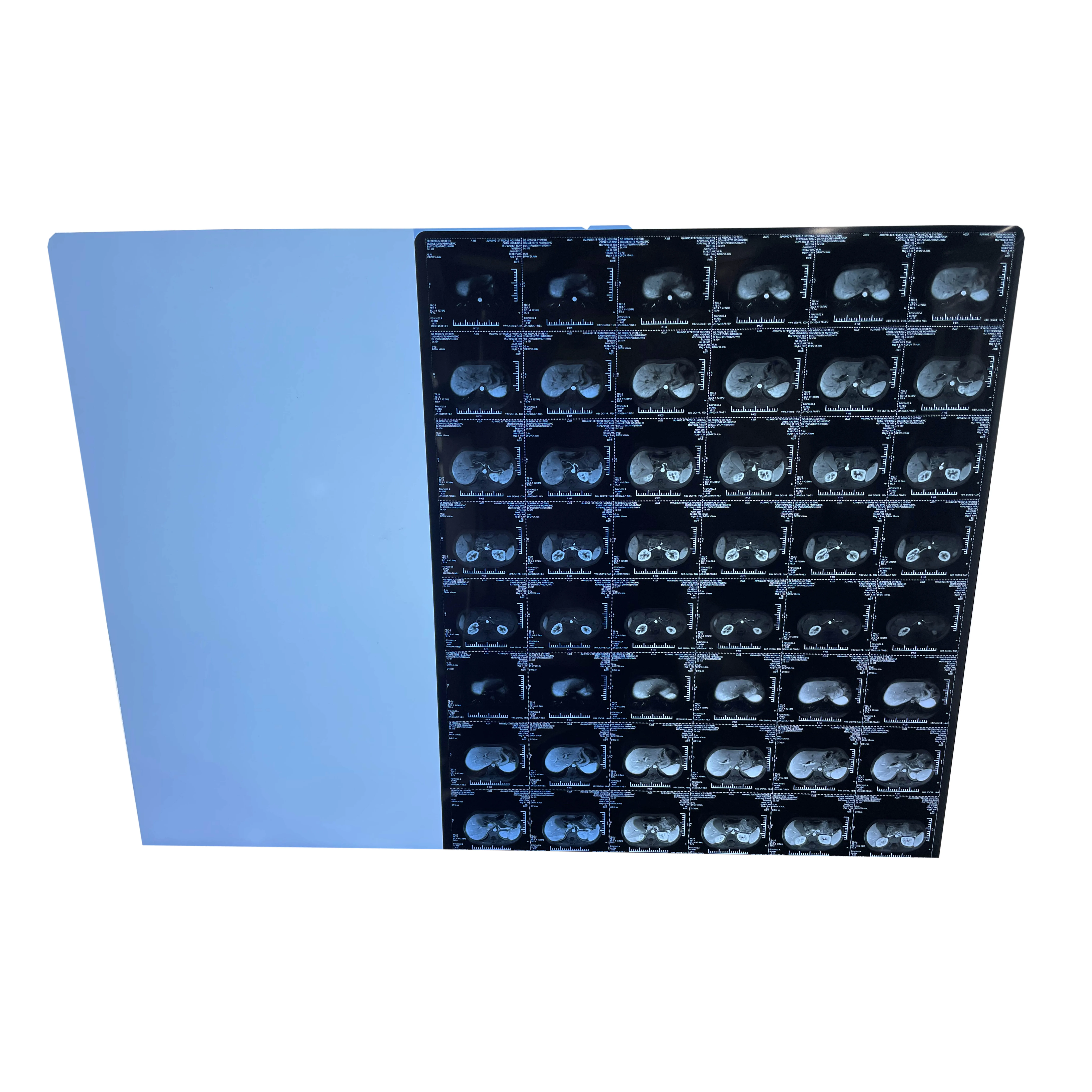 Medical X--Ray film Digital film 10*12 Inch Fuji Printing Medical film OEM & ODM