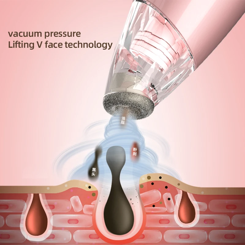 New Facial Pore Cleaner Blackhead Remover Vacuum Suction Beauty Device