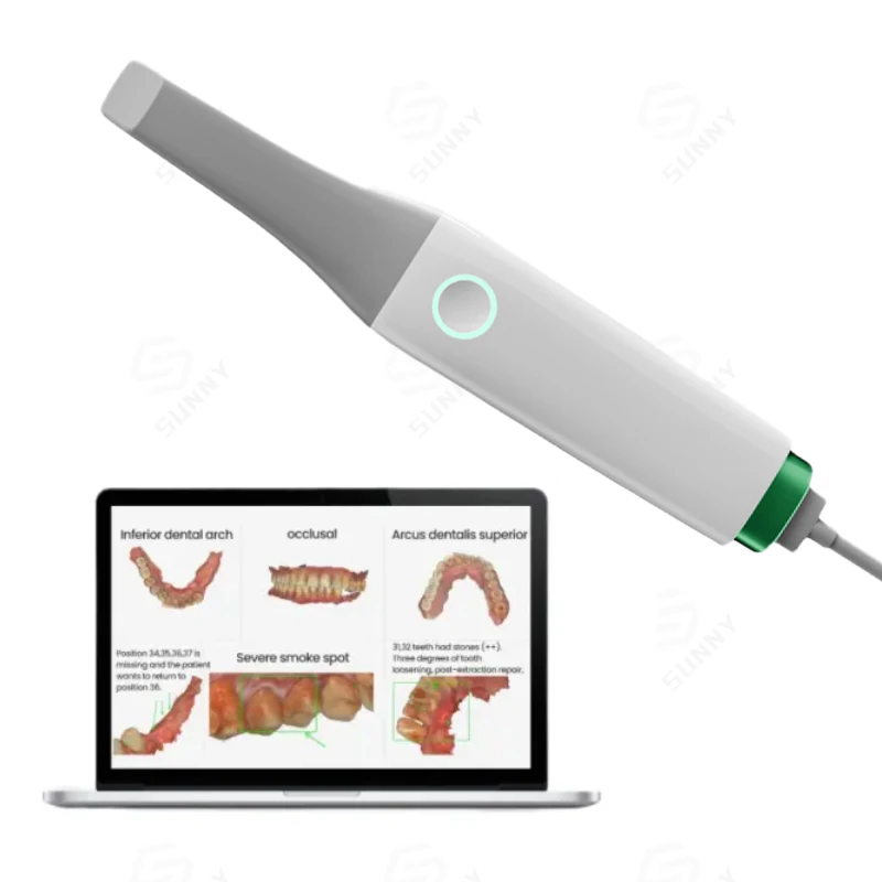 3D Oral Camera Dental Scanner Handheld Portable  Intra Oral Camera Dental 3D Scanner Intraoral