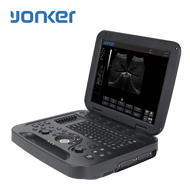 Yonker Portable Ultrasound Devices Mobility Meets Medicine ultrasound machine