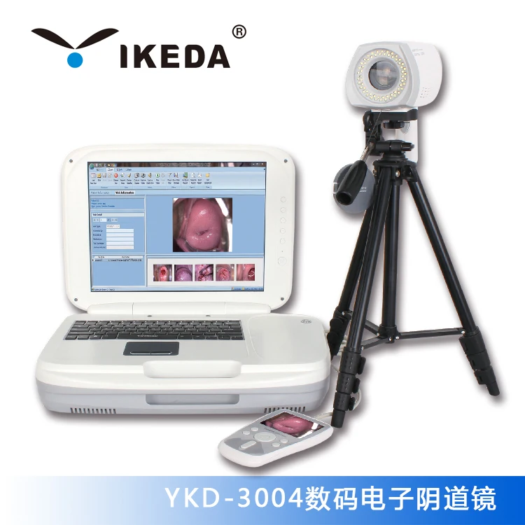 High resolution colposcope video camera colposcopy exam system digital colposcope AKX  YKD-3001