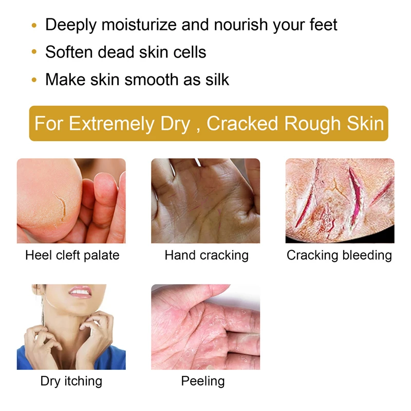 EELHOE cracked skin banana repair cream hand feet moisturizing heel cleft palate crack bleeding dry itches repairing cream