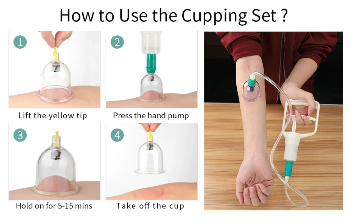 Chinese Medicine Cupping Therapy Sets,12Cups Hijama Cupping Set with Pump Vacuum Suction Cups for Body Cellulite Cupping