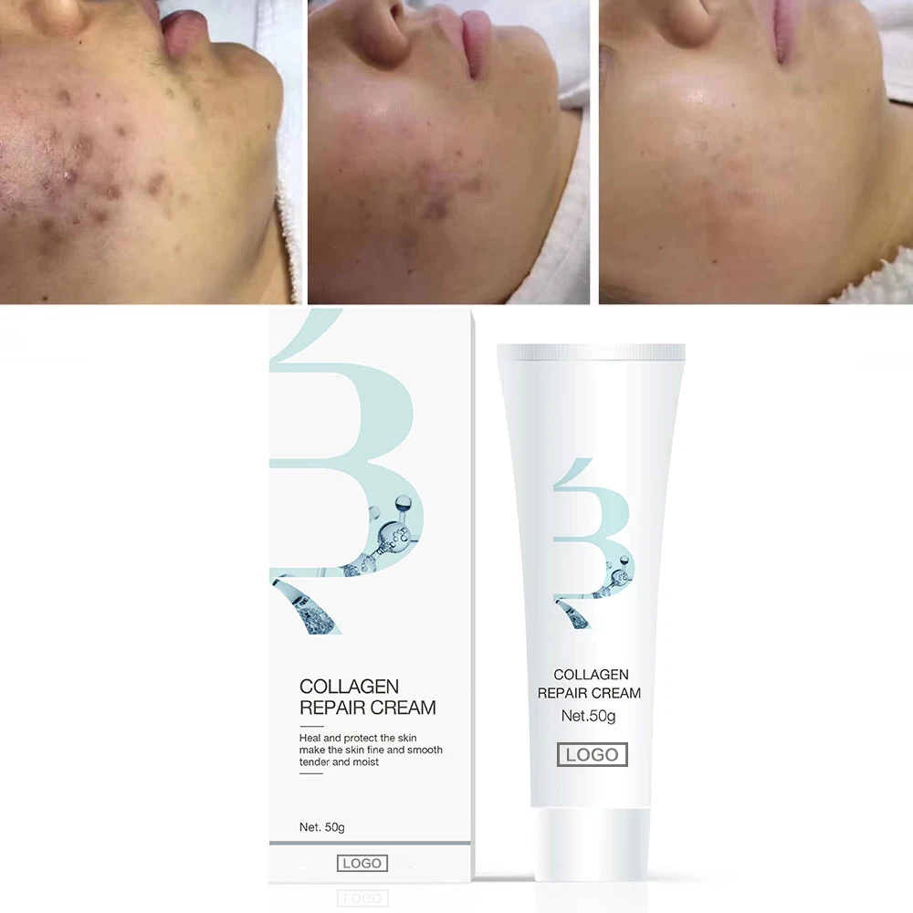 Private Label Barrier Repair Skin Care Cream Adult Recombinant Humanized Type III Collagen Repairing Face Cream for Acne Scar