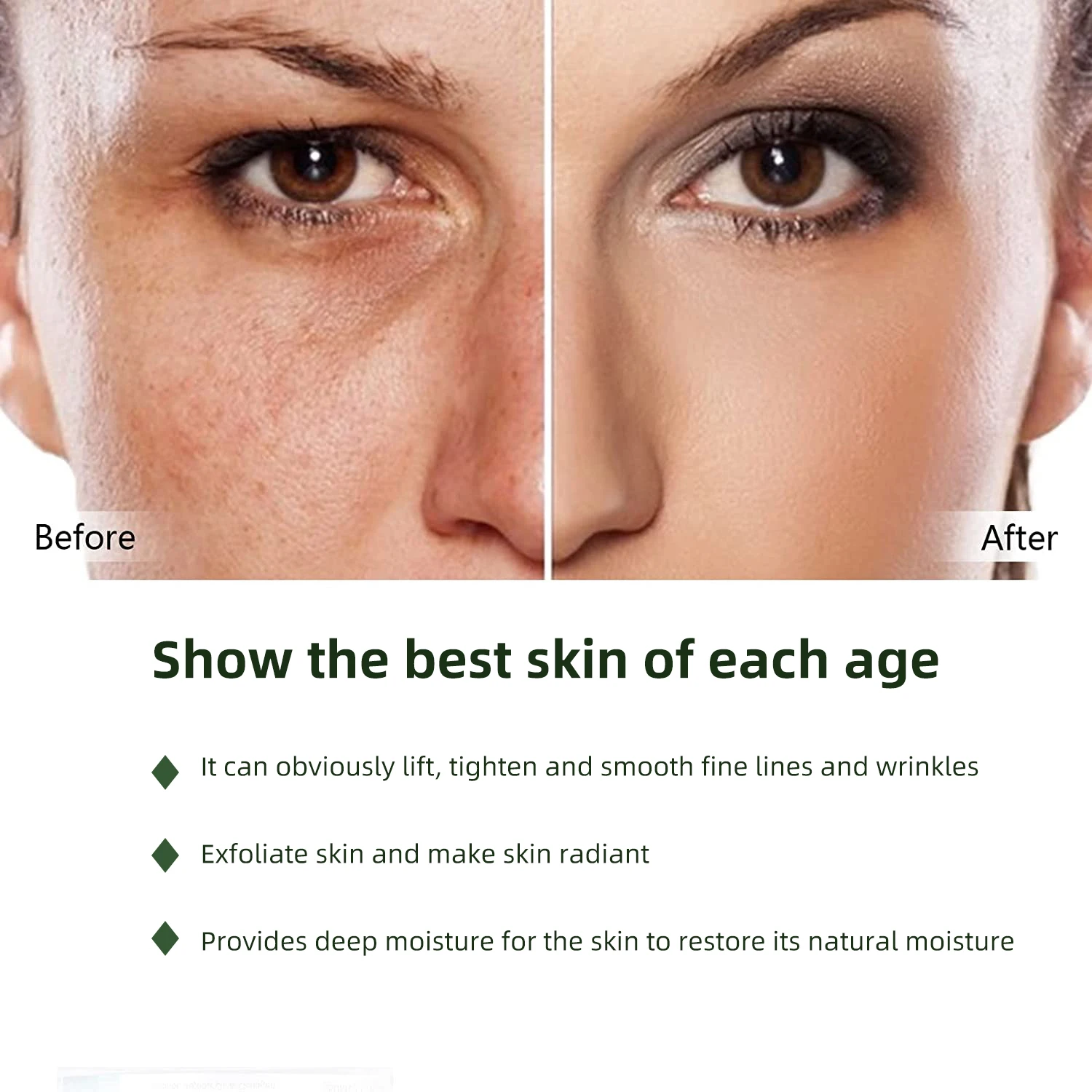 Custom Logo Cosmetic Skin Care Whitening and Moisturizing Skin Care Set All Natural Organic Vegan Anti Ance Skin Care Gift Set