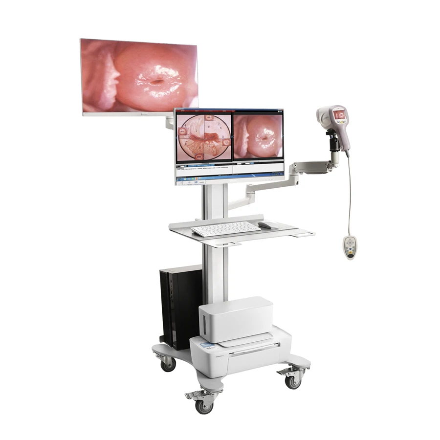 HD Video Colposcope for Obstetrician-Gynecologist Vaginal Examination