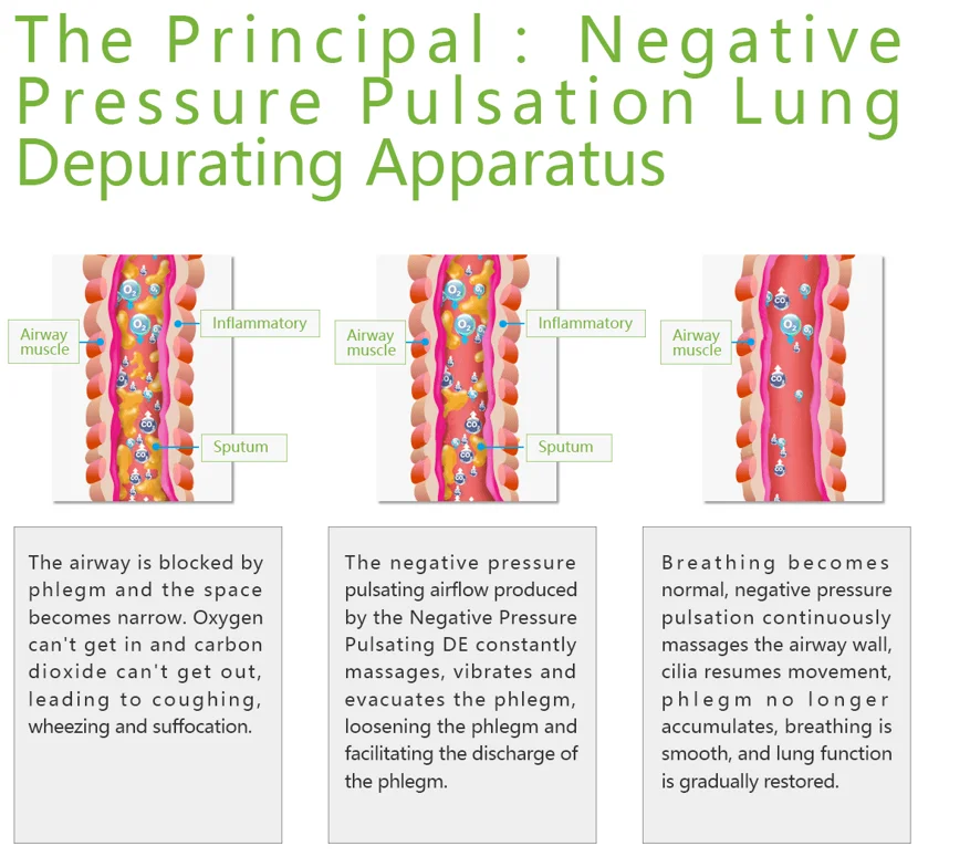 The Lung Clear Device is an instrument that helps to improve airway obstruction caused by bronchiectasis and obstructive
