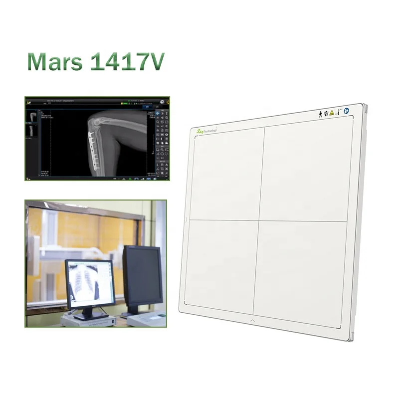 Iray and CareView Veterinary and human FPD Mars 14*17 wireless DR Panel digital x ray flat panel detector for X Ray Machine