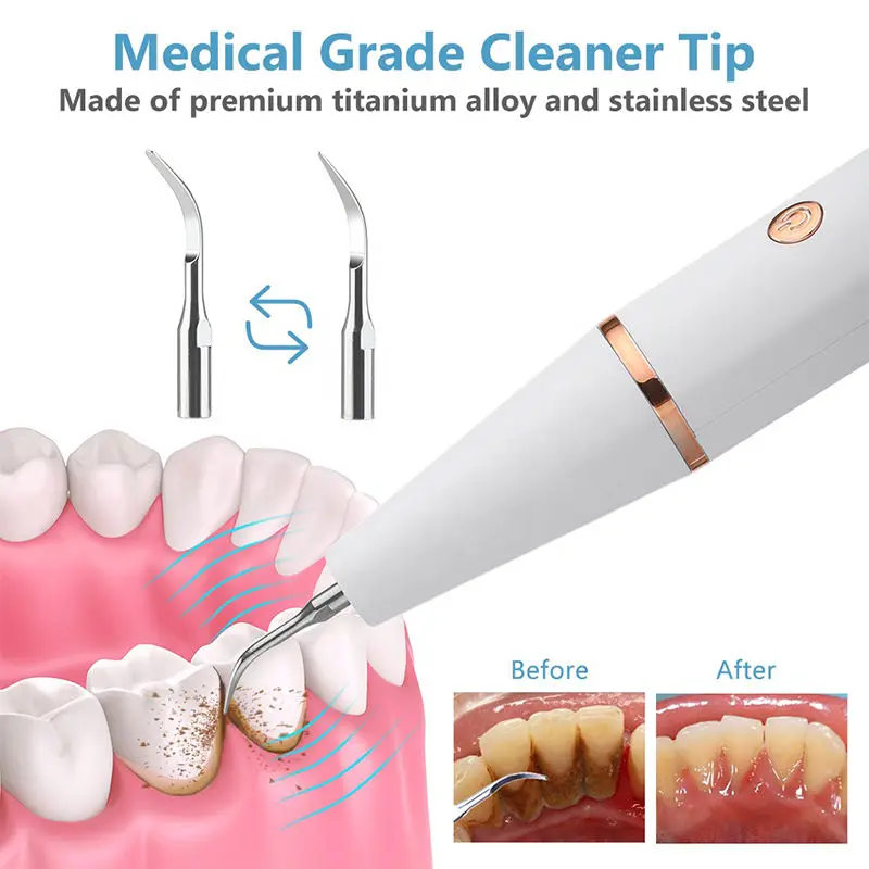 Sale 2022 new Household Device Whitening Tool Stain Kit Calculus Electric Plaque Remover For Teeth Ultrasonic Tooth Cleaner