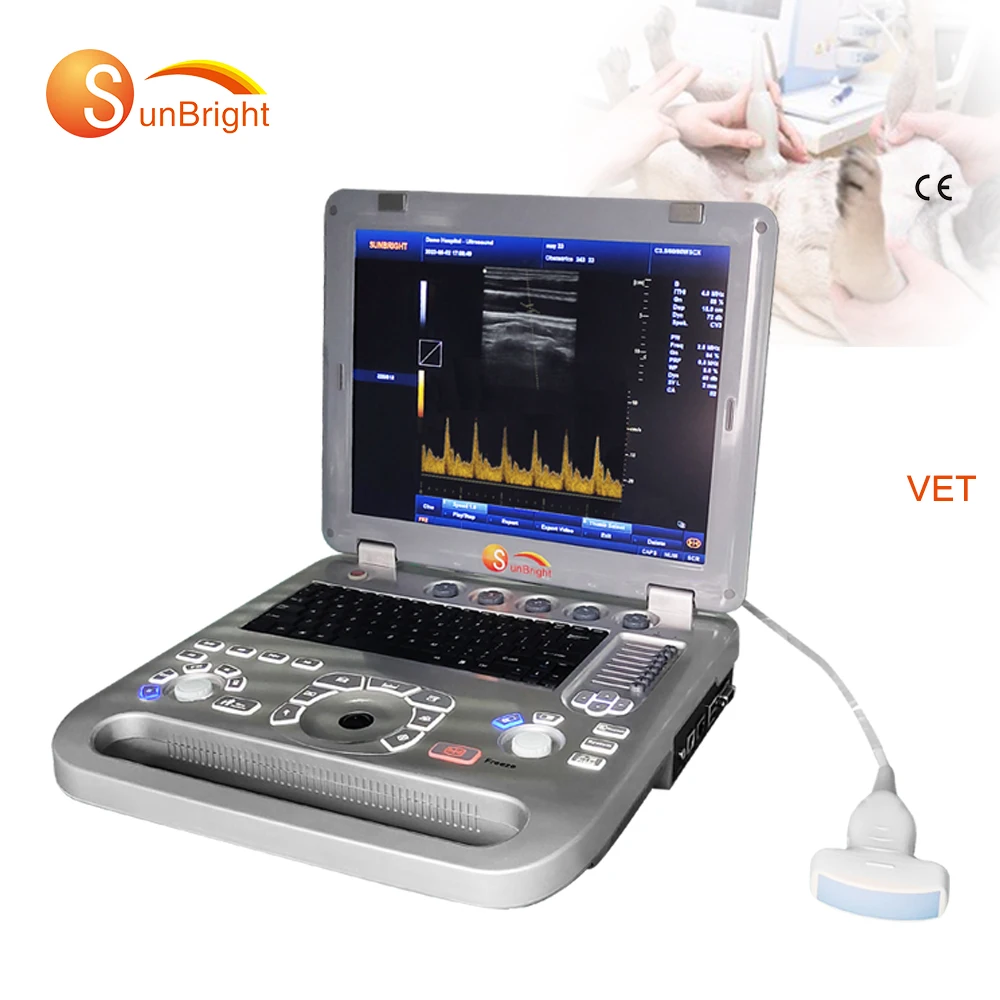 3d medical portable pw free doppler ultrasound sunbright ultrasound scanner SUN-800F