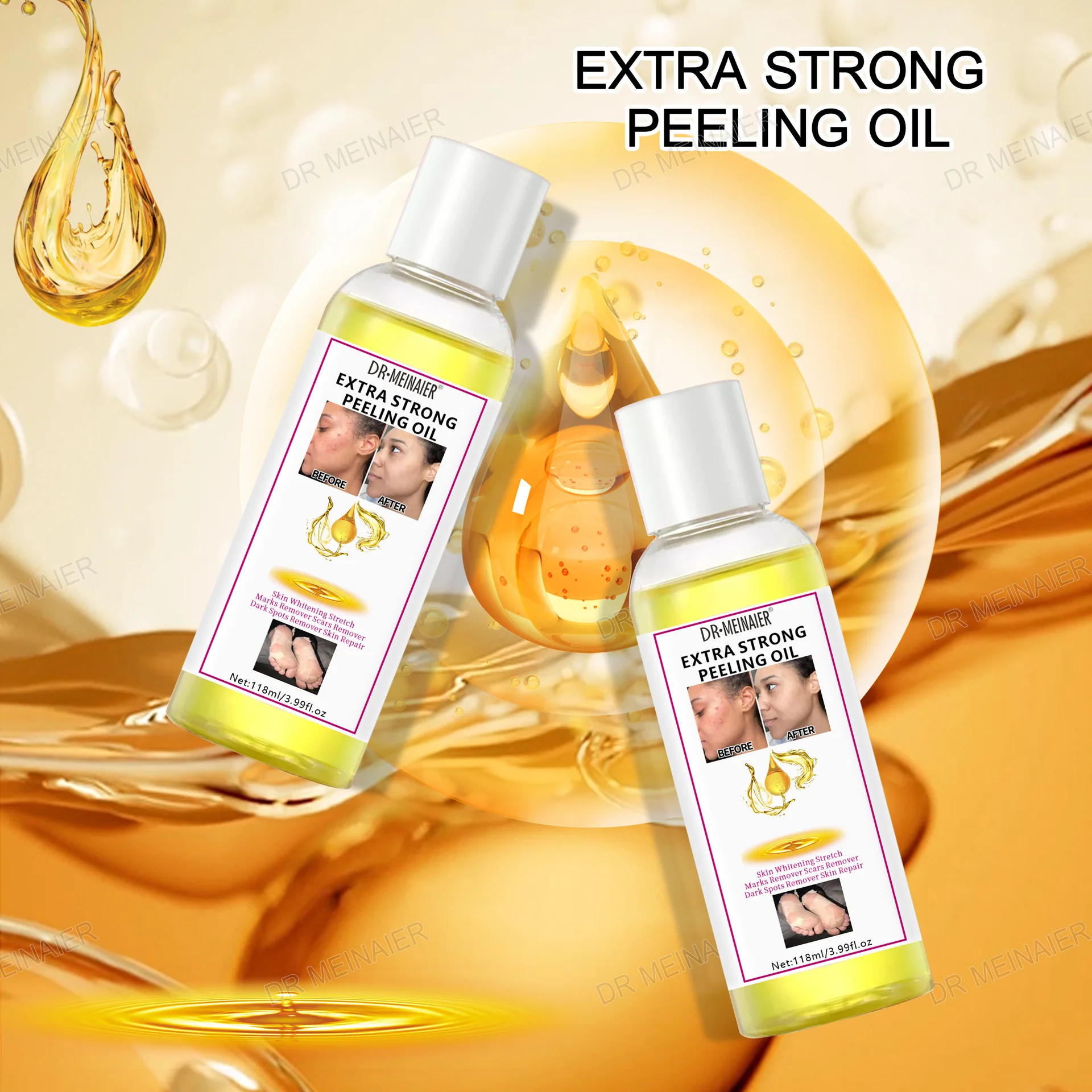 wholesale herbal black skin strong bleaching oil vitamin c dead skin remover african skin whitening yellow orange peeling oil