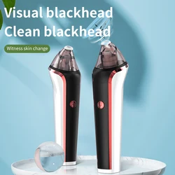 Custom wholesale electric pore nose cleaner  mobile phone visual portable mini facial whitehead vacuum blackhead remover