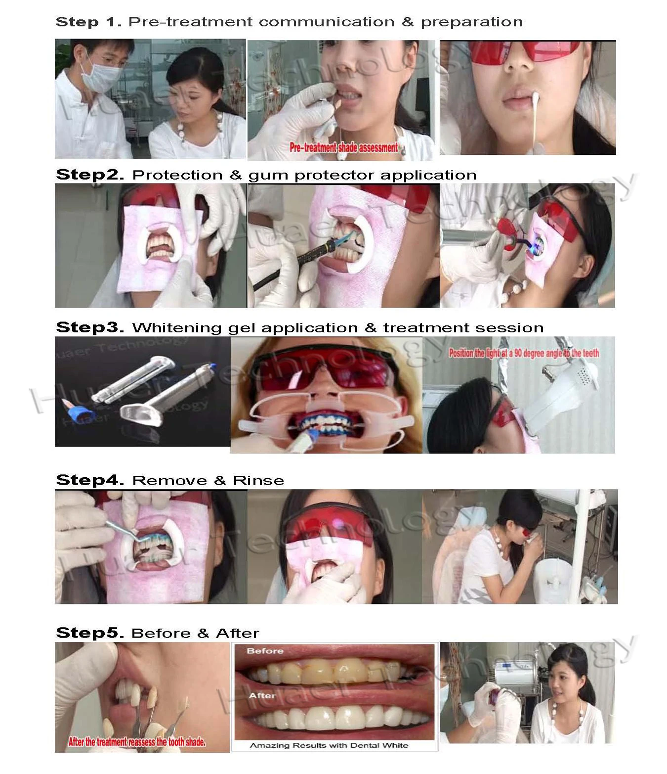 Оптовая продажа, профессиональный стоматологический салон, стоматологический отбеливающий 35%, отбеливающий отбеливатель 44% перекиси, набор для отбеливания зубов, частный логотип