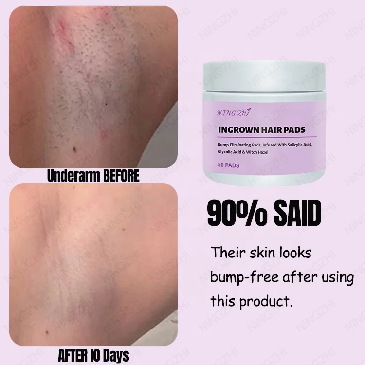 NingZhi Customized logo Glycolic Salicylic Acid Exfoliant Ingrown Hair Peeling Exfoliating Pads