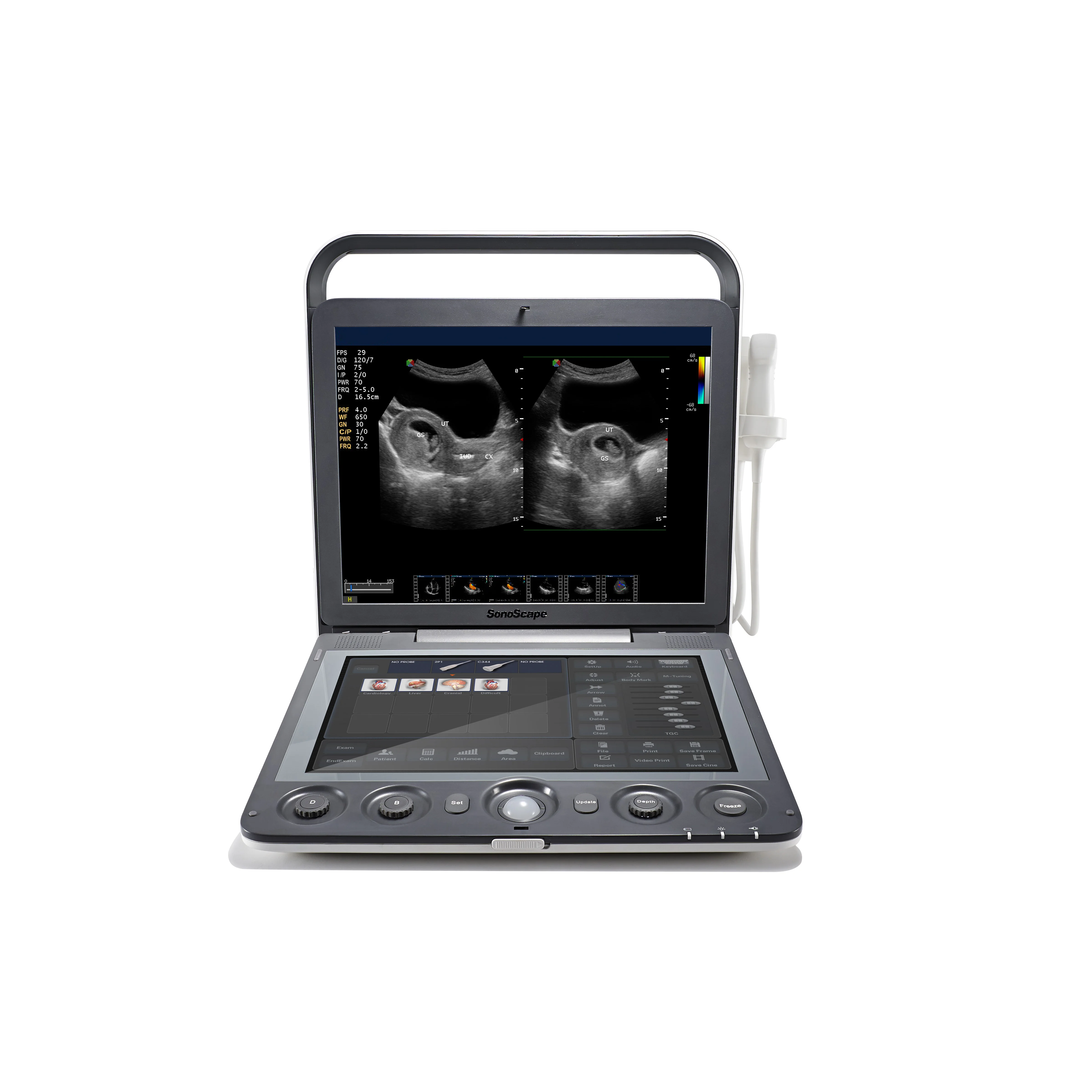 S9 Vet ultrasound scanner machine for pregnancy