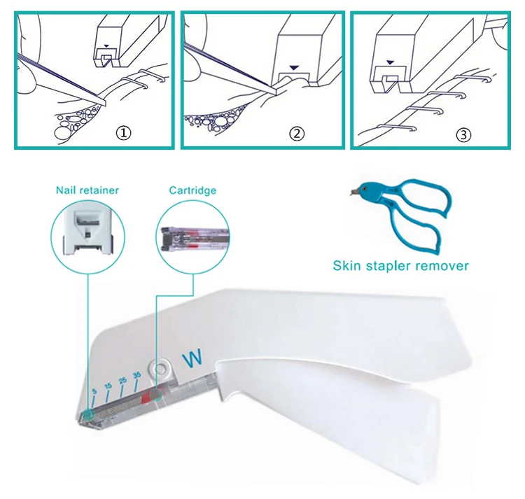 skin stapler and surgical staples