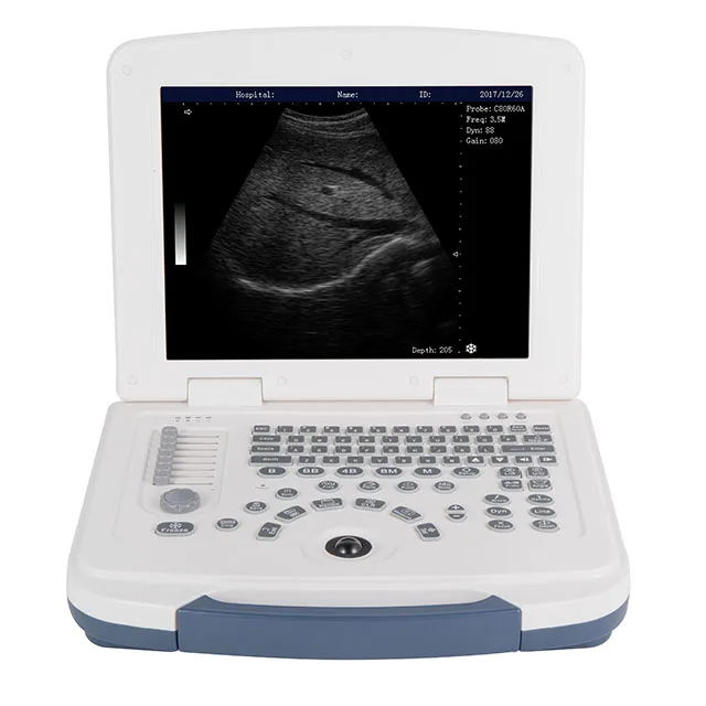 Portable ultrasound machine Sonography machine with convex probe Full digital 80 elements Backlit silica keyboard