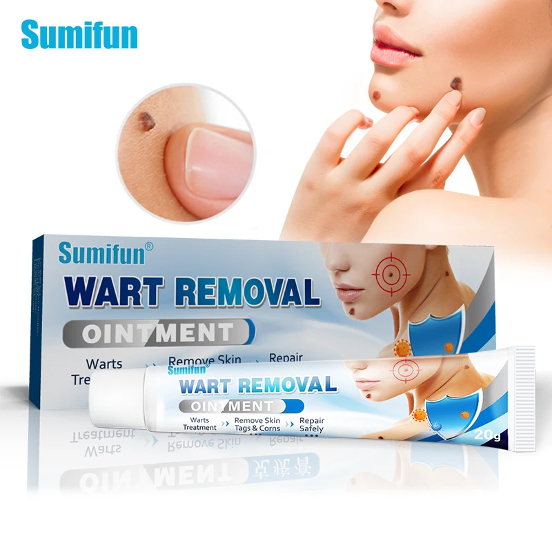 Sumifun Warts Remover Cream Herbal Extract Antibacterial Ointment Skin Tag Remover Foot Corn Plaster Warts Care Ointment
