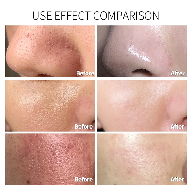 Wholesale skin care glitter facial blackhead remover peel of mask deep cleansing black head peel off face mask