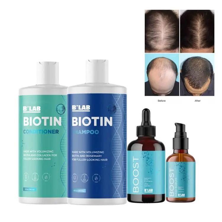 Biotin Hair Growth Shampoo Set OEM Customized Label Biotin oil Hair-Loss Prevention Thickening Shampoo for  Fine Hair