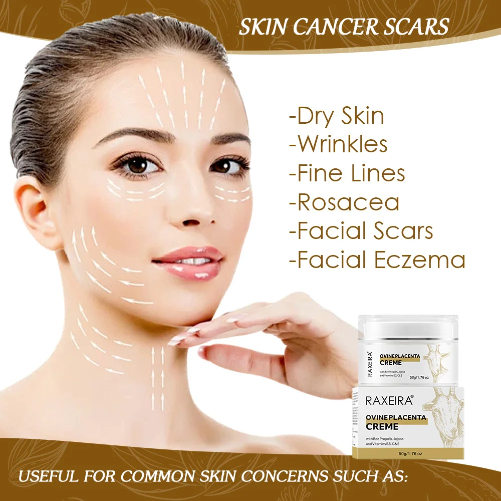 New Arrival Anti-Wrinkle Ovine Placenta Cream Ideal For Rejuvenating Tired And Unhealthy Skin