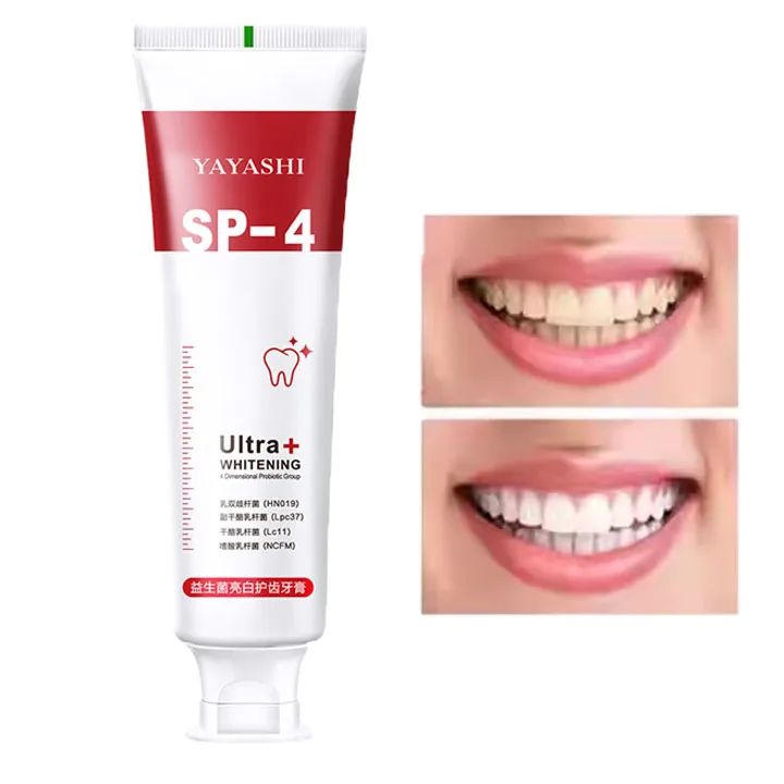 Authentic probiotics whitening stain removal toothpaste to improve bad breath yellow teeth men and women 120g wholesale