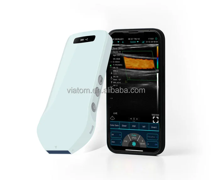 Портативный Беспроводной ультразвуковой сканер Viatom ABCDE 192 элементы ручной высокочастотный линейный цветной беспроводной зонд