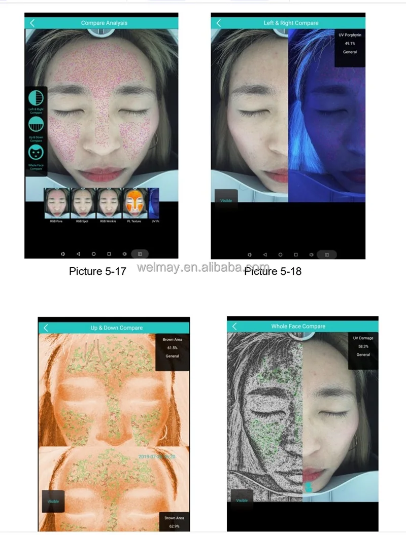 Clinic Spa Salon Welmay Face Scope Skin Analyser Health Skin Complexion Machine Facial Skin Analyzer