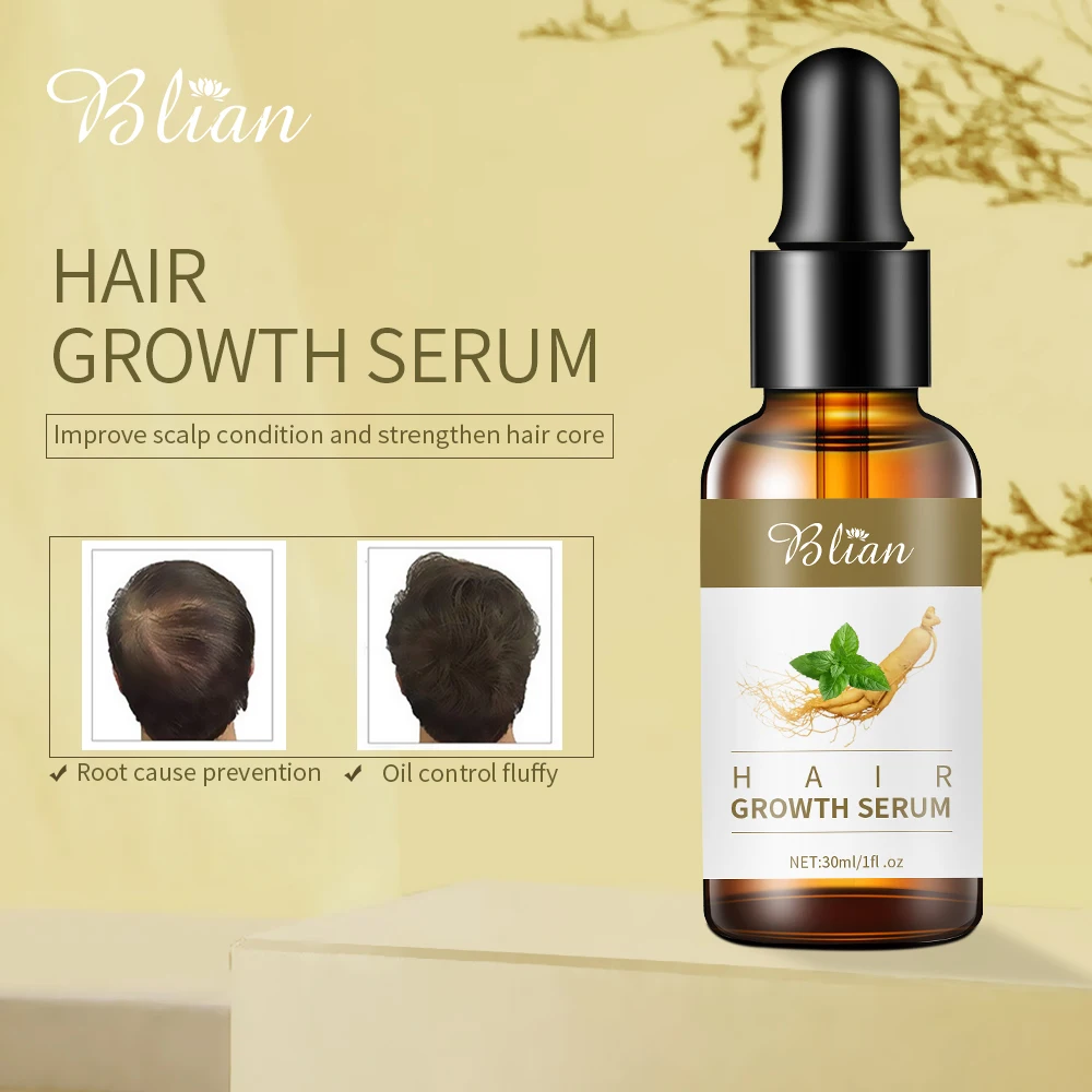 Private Label Natural Organic Vegan Treatment For Bald Hair Serum Wholesale Herbal Anti Hair Loss Boosting Hair Growth Oil