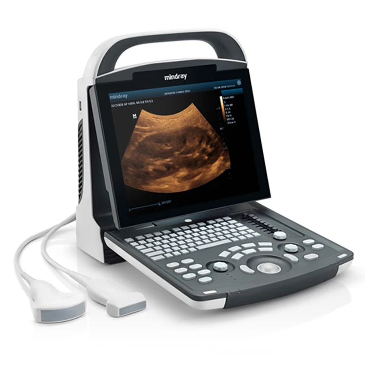 Mindray DP-20 Ultrasound Scanner Price Medical Instruments B/W Portable