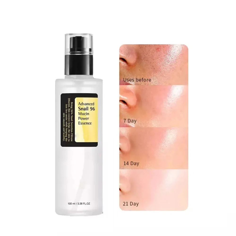 Advanced Snail 96 Mucin Power Essence 100ml Snail Secretion Filtrate 96.3% for Anti-aging Nourishing Wrinkle Improvement