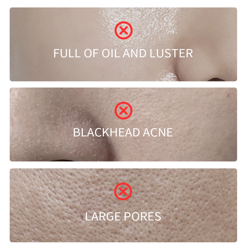 Natural Organic Vegan Kaolin Clay Facial Mask Whitening Nourishing Hydrating Deep Cleansing Pore For All Skin Types clay mask