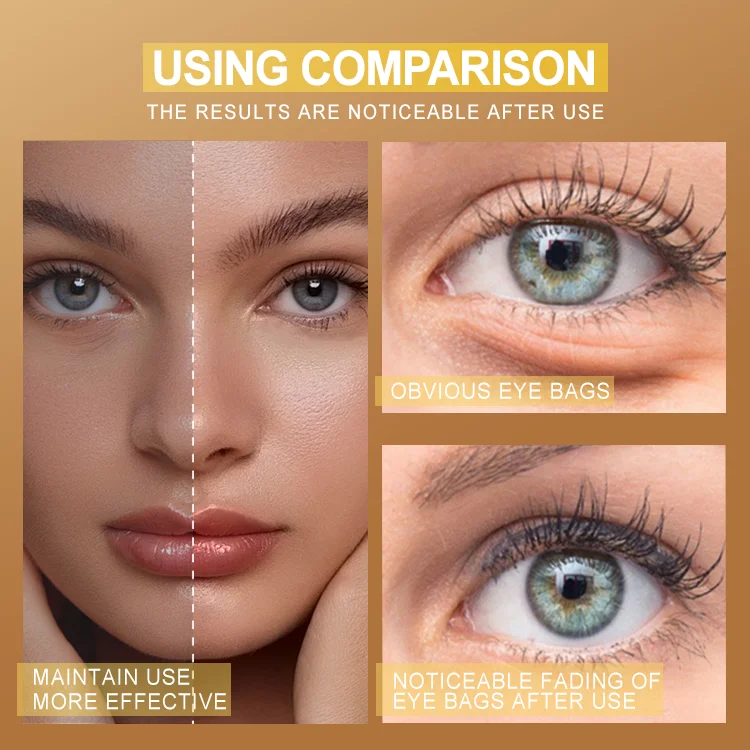 Reduce aging and dryness under eye patches custom under eye patches under eye patch for dark circles bags puffiness