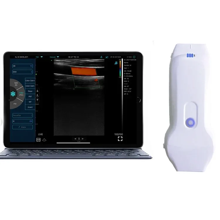 MC28  Perfect performance wifi&usb ultrasound probe scanner with phased array cardiac and linear