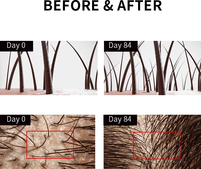 New Popular Fashion Style fashion turmeric shampoo Strengthen hair roots ginger king shampoo