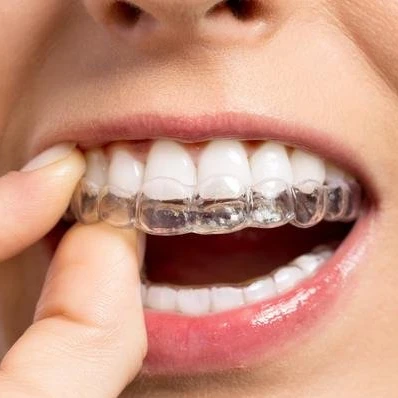 PETG material dental transparent thermoforming resin retainer sheet / orthodontic splint aligner sheet for dental lab use