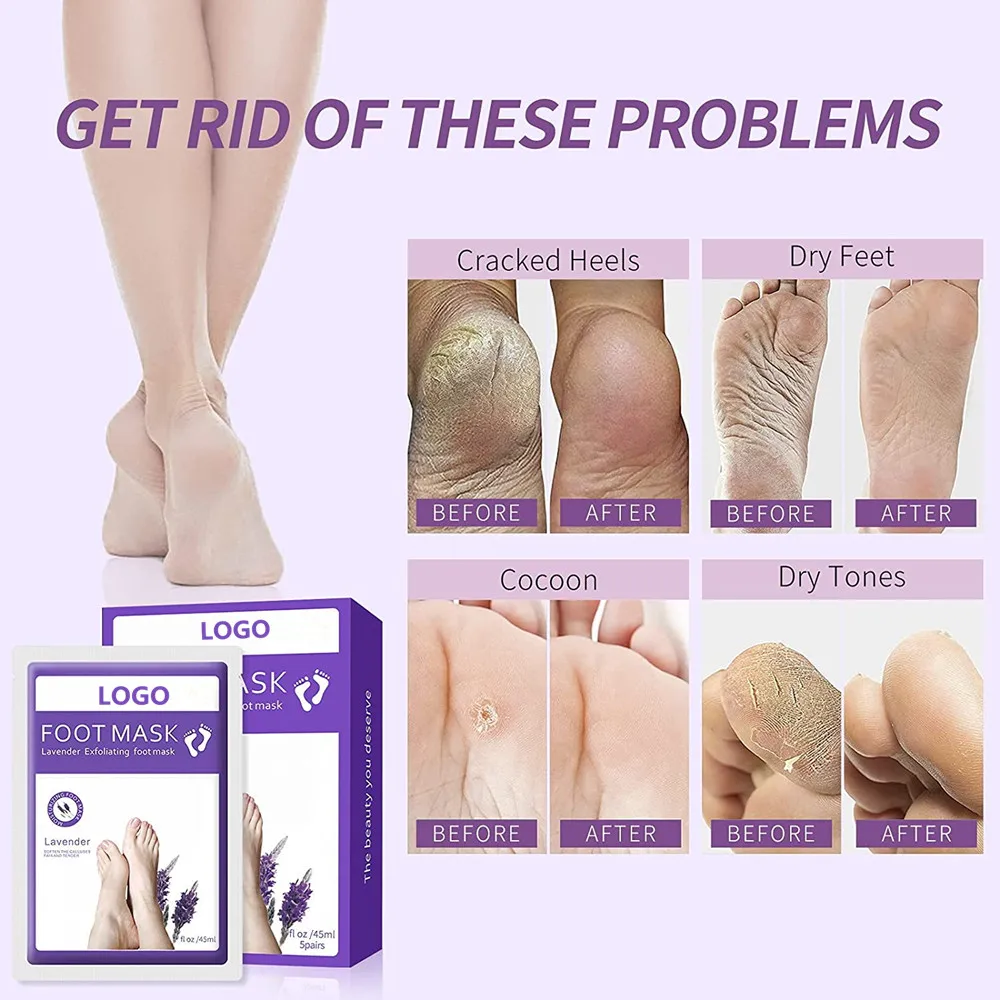 Wholesale Natural Treatment Feet Peeling Exfoliating Lavender Foot Mask
