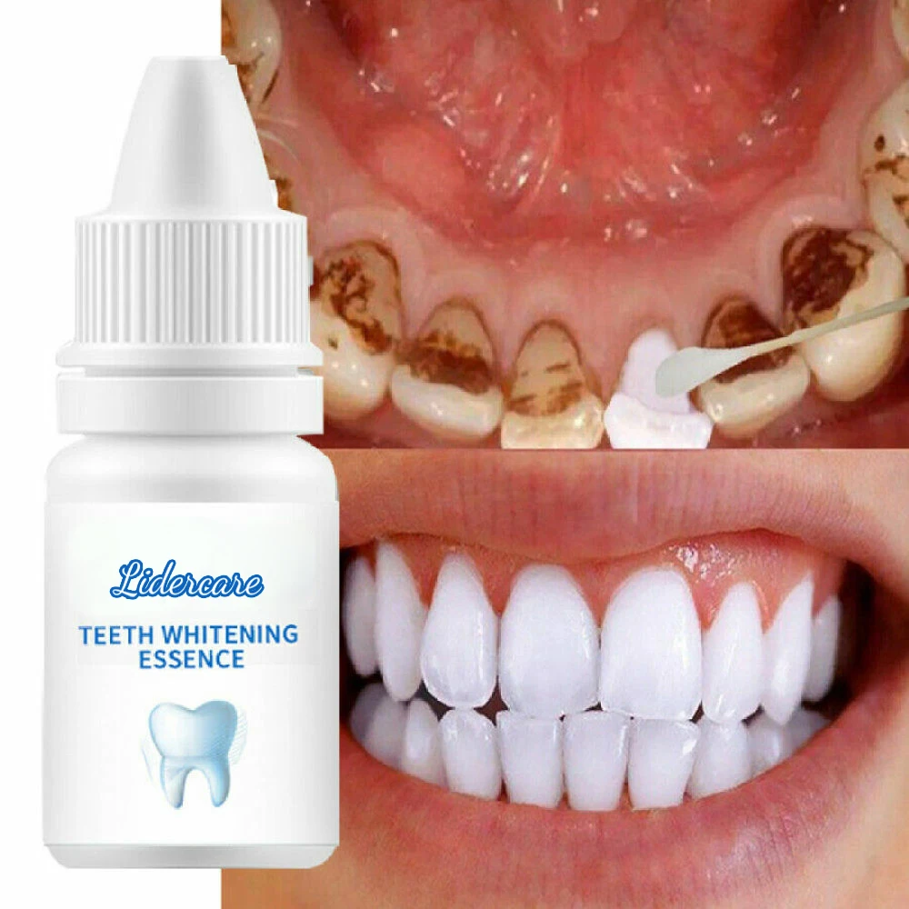 OEM ODM отбеливающая эссенция для зубов