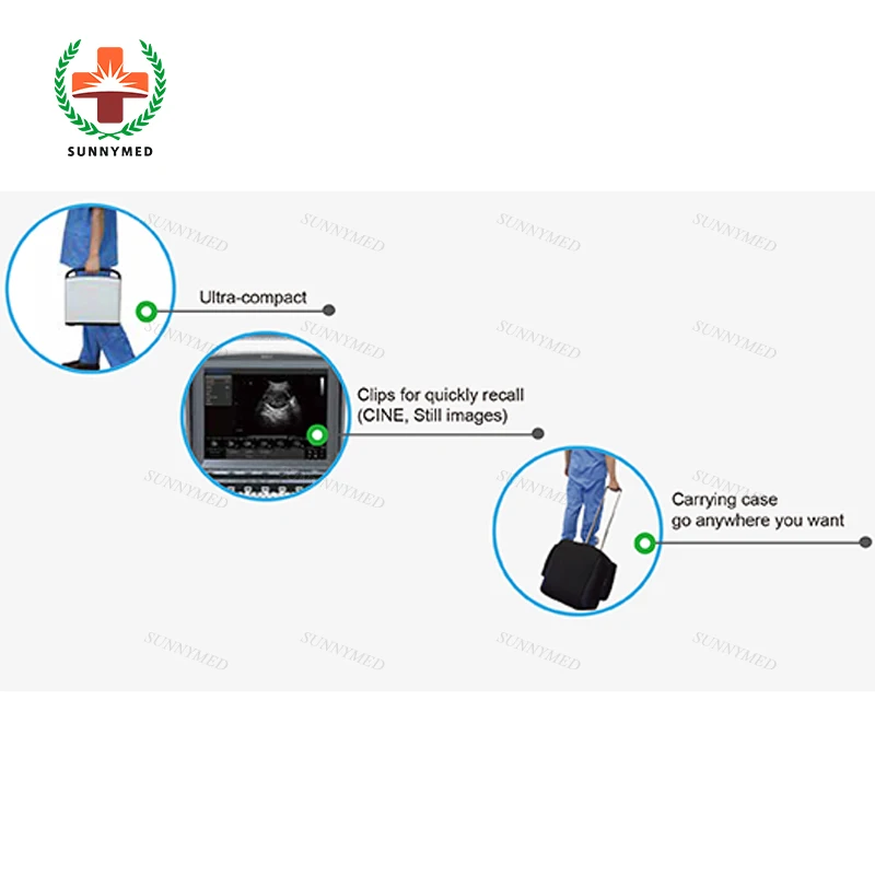  Chison medical Eco1 Eco3 advanced BW портативная ультразвуковая машина с функцией