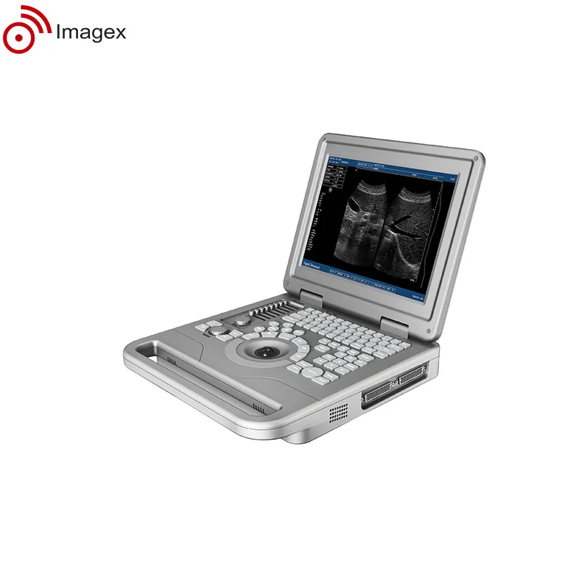 Портативный ультразвуковой аппарат с многочастотными зондами для акушерства и гинекологии
