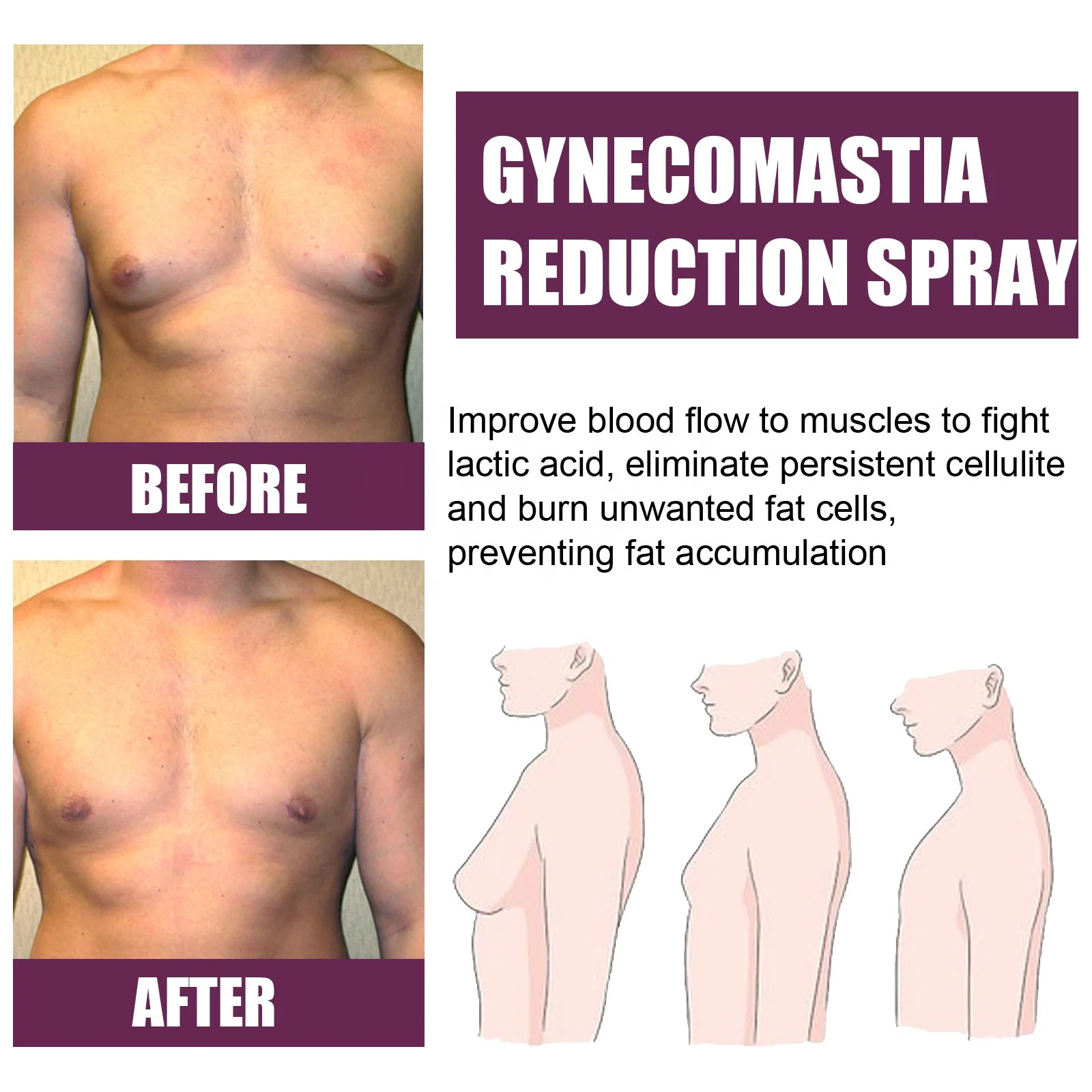 Organic Tightening Cream Breast Slimming Cream Reduction Treat Gynecomastia cream