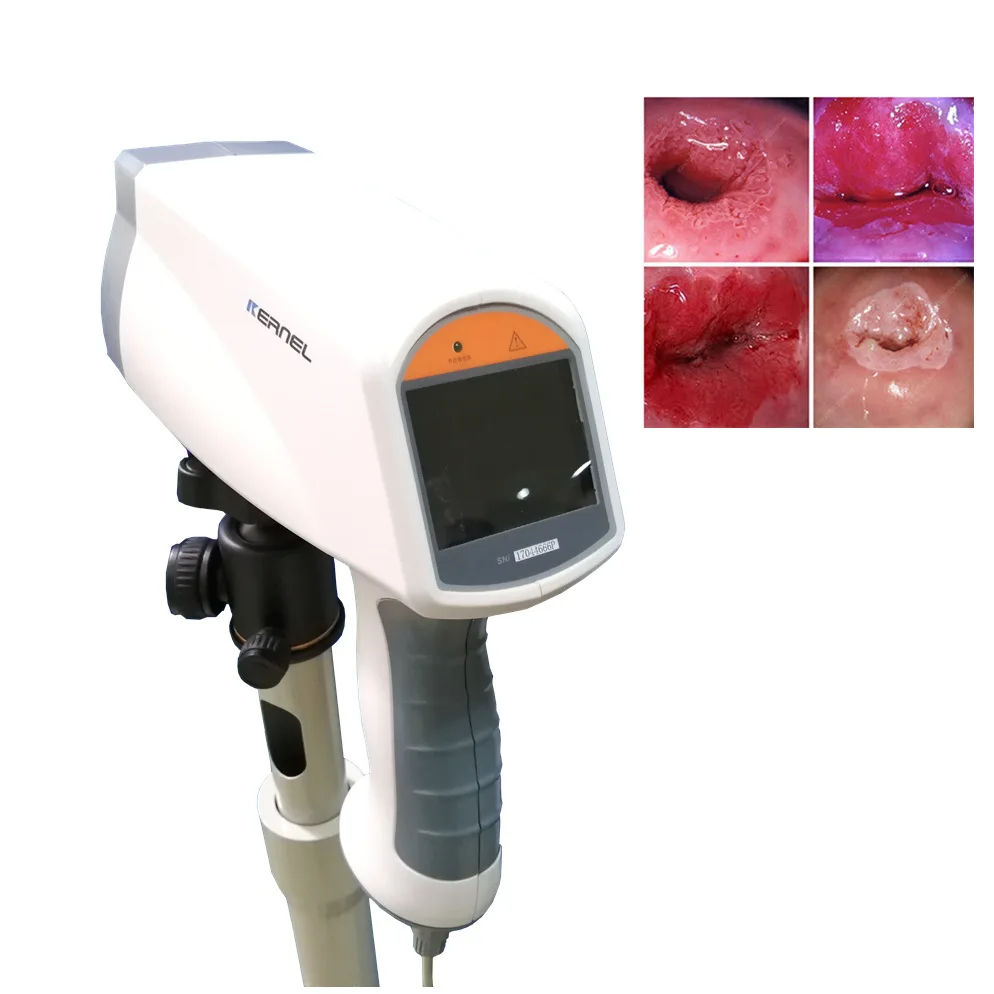 Портативный гибкий одноразовый набор кольпоскопа эндоскопа для гинекологии хирургическое оборудование кольпоскопии